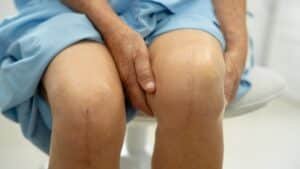 Diary Of A Total Knee Replacement  | Sixty And Me