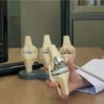 a-simple-guide-to-knee-replacement-surgery-|-sixty-and…