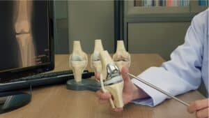 a-simple-guide-to-knee-replacement-surgery-|-sixty-and…